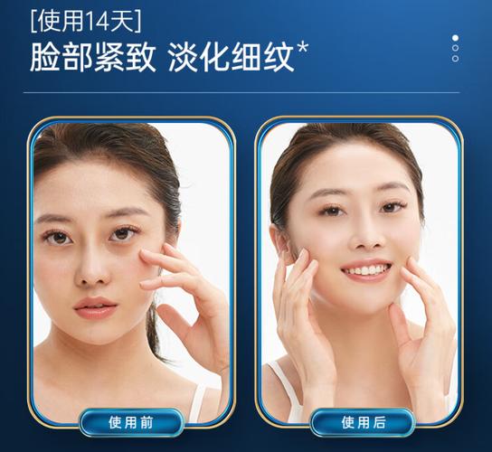 介绍去皱美容仪器,市面上的热销产品对比介绍_去皱美容仪器对比 介绍去皱美容仪器,市面上的热销产品对比介绍_去皱美容仪器对比 养生保健