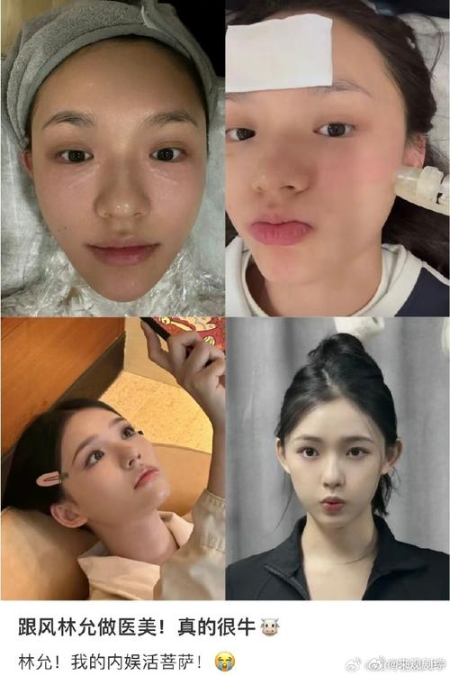 林允美容仪器体验分享,科技美容，让美丽触手可及_林允美容仪器视频 林允美容仪器体验分享,科技美容，让美丽触手可及_林允美容仪器视频 饮食拾萃