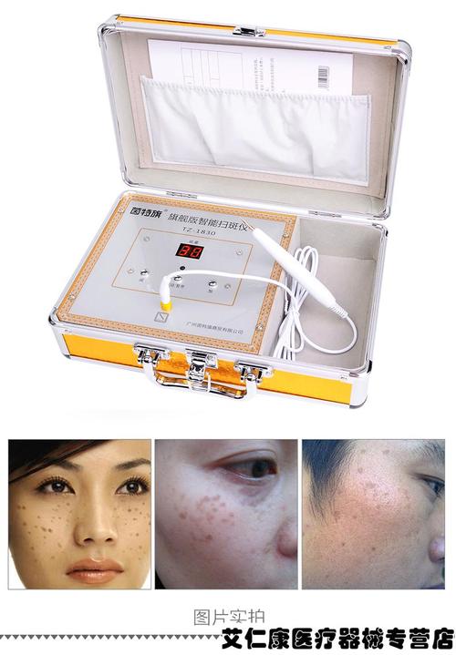 激光点痣仪器美容,科技与美的完美融合_激光点痣仪器美容 激光点痣仪器美容,科技与美的完美融合_激光点痣仪器美容 服饰装扮