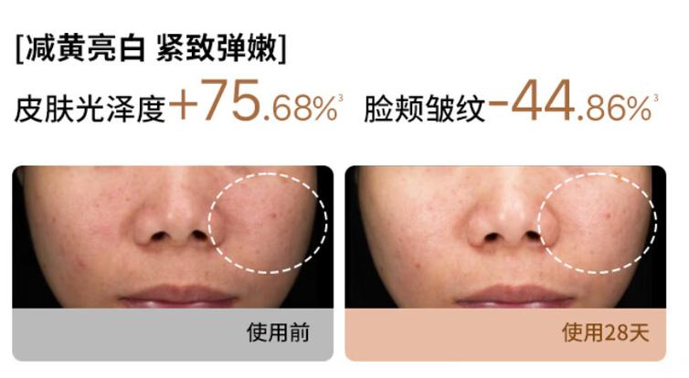 科技美容新篇章,美容仪器前后对比，见证肌肤蜕变之旅_美容仪器前后对比图片 科技美容新篇章,美容仪器前后对比，见证肌肤蜕变之旅_美容仪器前后对比图片 养生保健