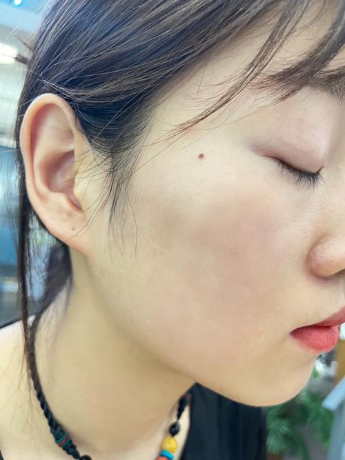美容激光仪器购买流程介绍,选购指南与注意事项_美容激光仪器购买流程 美容激光仪器购买流程介绍,选购指南与注意事项_美容激光仪器购买流程 美容塑身