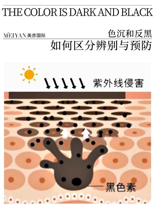介绍美容仪器反黑现象,原因、影响及应对步骤 介绍美容仪器反黑现象,原因、影响及应对步骤 旅行地理
