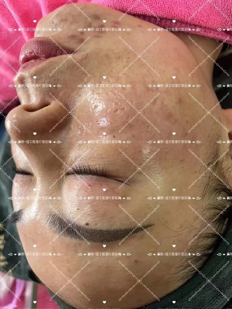 仪器美容祛斑,科学验证下的美丽奇迹 仪器美容祛斑,科学验证下的美丽奇迹 美容塑身