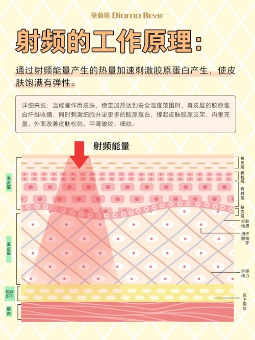 光电与射频,美容仪器两大领域的较量与融合 光电与射频,美容仪器两大领域的较量与融合 日用科普