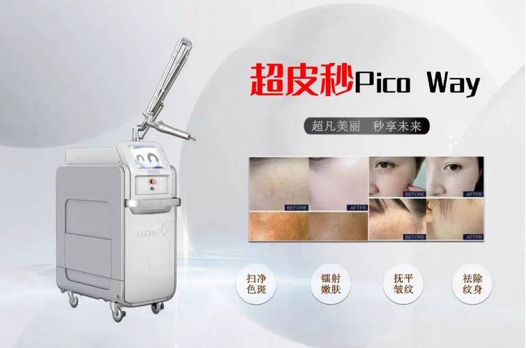光电美容仪器,美丽与健康的完美融合 光电美容仪器,美丽与健康的完美融合 饮食拾萃