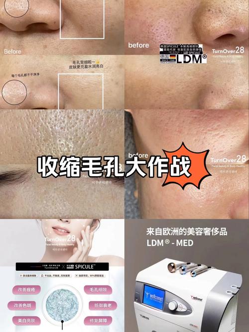 全方位介绍改善毛孔粗大美容仪器,科技护肤新篇章 全方位介绍改善毛孔粗大美容仪器,科技护肤新篇章 美容塑身