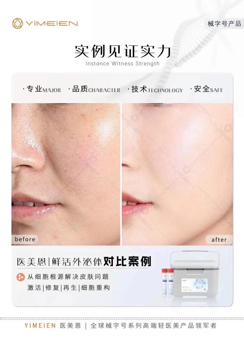 全球美容仪器品牌盘点,引领科技护肤潮流的佼佼者 全球美容仪器品牌盘点,引领科技护肤潮流的佼佼者 旅行地理