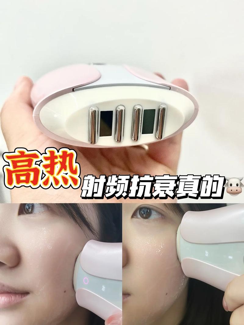 射频美容仪器HR,介绍射频技术在美容领域的神奇魔力 射频美容仪器HR,介绍射频技术在美容领域的神奇魔力 动手制作