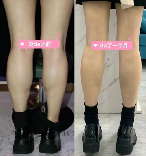 柠檬美容仪器瘦腿教程,科技与自然的完美结合，轻松拥有美丽双腿 柠檬美容仪器瘦腿教程,科技与自然的完美结合，轻松拥有美丽双腿 养生保健