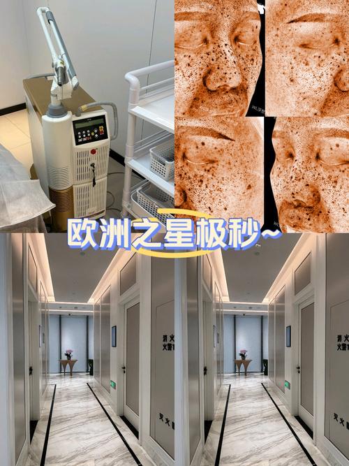 激光美容仪器出租,美丽经济的新趋势 激光美容仪器出租,美丽经济的新趋势 服饰装扮