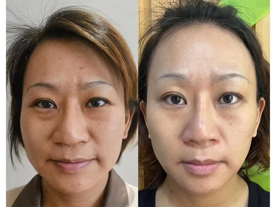 科技与美的交融_详细介绍测试仪器美容图片背后的真实高清世界 科技与美的交融_详细介绍测试仪器美容图片背后的真实高清世界 养生保健