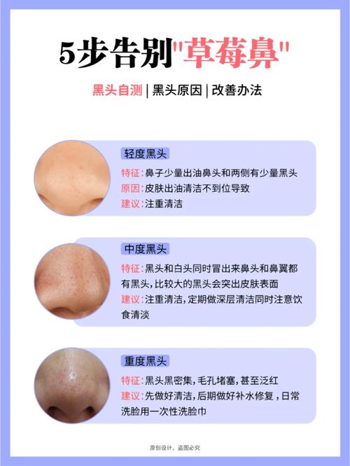 紫馨美容仪器凝胶_告别黑头，重拾肌肤净透光彩 紫馨美容仪器凝胶_告别黑头，重拾肌肤净透光彩 动手制作