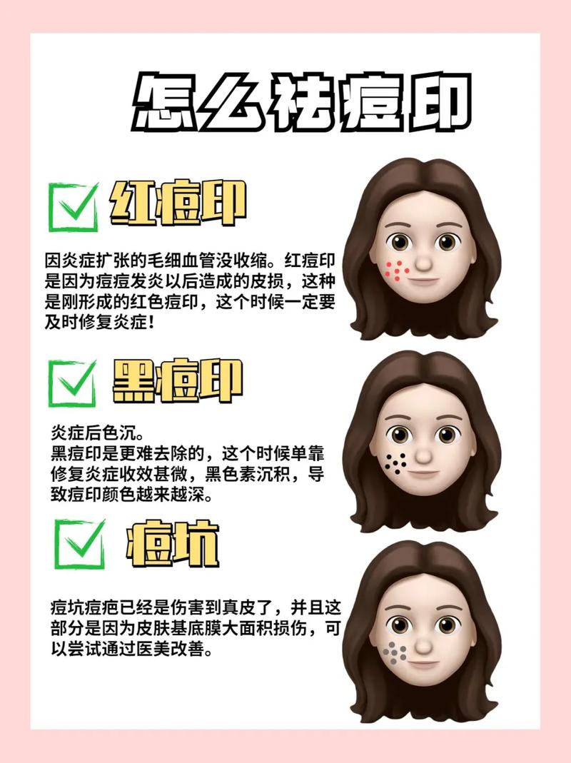 红蓝光祛痘印美容仪器,科技助力美丽肌肤，介绍祛痘印新趋势 红蓝光祛痘印美容仪器,科技助力美丽肌肤，介绍祛痘印新趋势 美容塑身