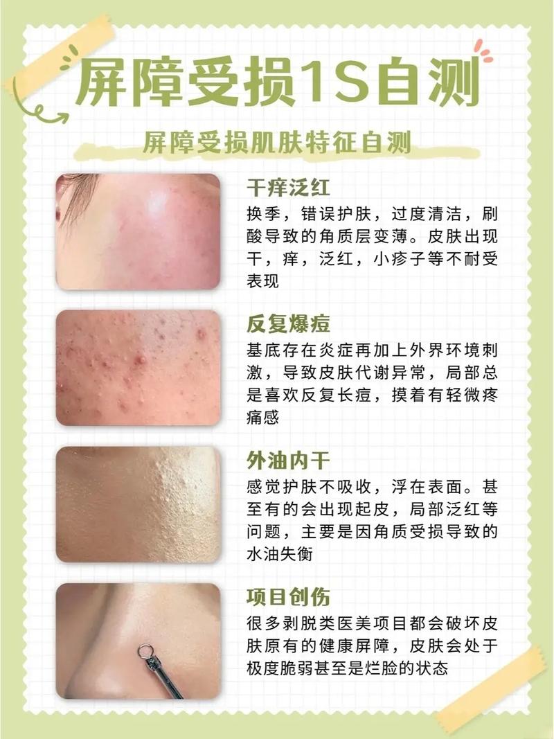 美容仪器,美丽背后的“破坏者”_介绍皮肤屏障受损之谜 美容仪器,美丽背后的“破坏者”_介绍皮肤屏障受损之谜 饮食拾萃