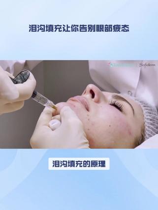 美容仪器助你告别泪沟，重拾青春光彩 美容仪器助你告别泪沟，重拾青春光彩 动手制作