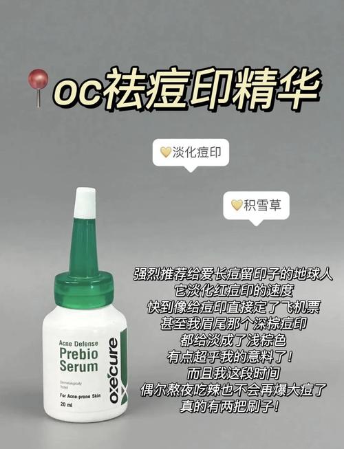 美容仪器去痘印效果介绍,科技助力美丽，告别痘印困扰 美容仪器去痘印效果介绍,科技助力美丽，告别痘印困扰 家居时尚