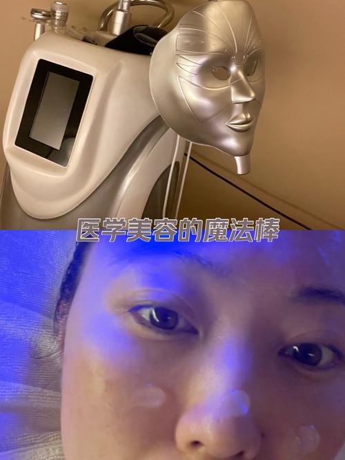 美容仪器脸部打圈,美容界的神奇魔法介绍其效果与原理 美容仪器脸部打圈,美容界的神奇魔法介绍其效果与原理 饮食拾萃